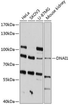 Western blot analysis of extracts of various cell lines using DNAI1 Polyclonal Antibody at 1:1000 dilution.