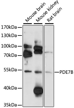 Western blot analysis of extracts of various cell lines using PDE7B Polyclonal Antibody at 1:1000 dilution.