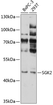 Western blot analysis of extracts of various cell lines using SGK2 Polyclonal Antibody at 1:1000 dilution.