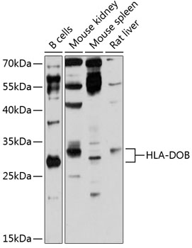 Western blot analysis of extracts of various cell lines using HLA-DOB Polyclonal Antibody at 1:3000 dilution.