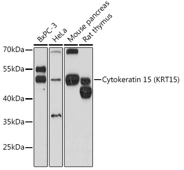 Western blot analysis of extracts of various cell lines using Cytokeratin 15 Polyclonal Antibody at1:3000 dilution.