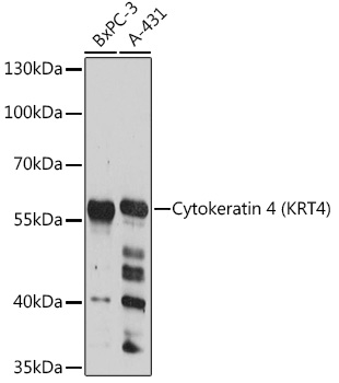 Western blot analysis of extracts of various cell lines using Cytokeratin 4 Polyclonal Antibody at1:3000 dilution.