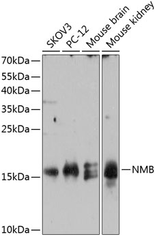 Western blot analysis of extracts of various cell lines using NMB Polyclonal Antibody at 1:3000 dilution.