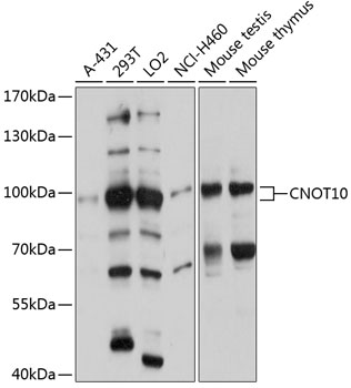 Western blot analysis of extracts of various cell lines using CNOT10 Polyclonal Antibody at 1:3000 dilution.