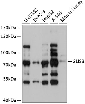 Western blot analysis of extracts of various cell lines using GLIS3 Polyclonal Antibody at 1:3000 dilution.