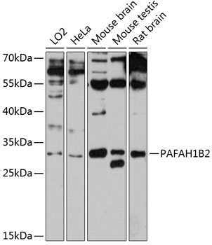 Western blot analysis of extracts of various cell lines using PAFAH1B2 Polyclonal Antibody at 1:3000 dilution.