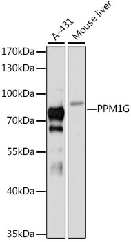 Western blot analysis of extracts of various cell lines using PPM1G Polyclonal Antibody at 1:3000 dilution.