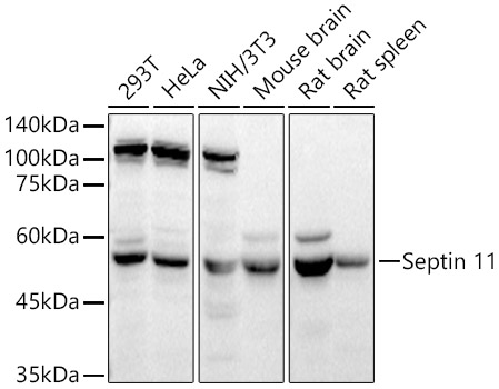 Western blot analysis of extracts of various cell lines using Septin 11 Polyclonal Antibody at 1:4000 dilution.