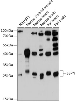 Western blot analysis of extracts of various cell lines using SSPN Polyclonal Antibody at 1:3000 dilution.