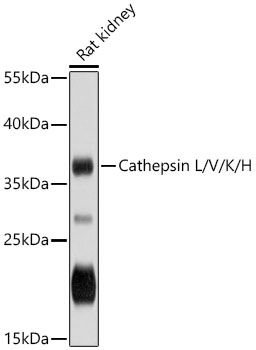 Western blot analysis of extracts of Rat kidney using Cathepsin L/V/K/H Polyclonal Antibody at 1:3000 dilution.