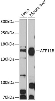 Western blot analysis of extracts of various cell lines using ATP11B Polyclonal Antibody at 1:1000 dilution.