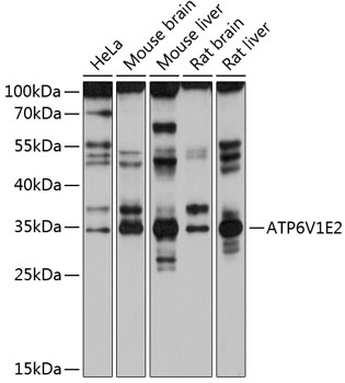 Western blot analysis of extracts of various cell lines using ATP6V1E2 Polyclonal Antibody at 1:1000 dilution.