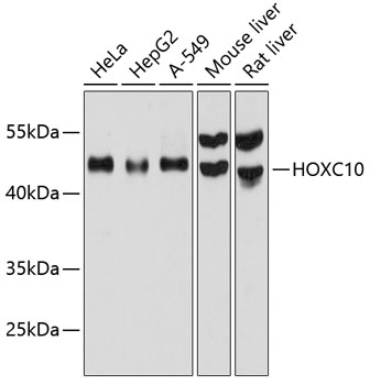 Western blot analysis of extracts of various cell lines using HOXC10 Polyclonal Antibody at 1:1000 dilution.