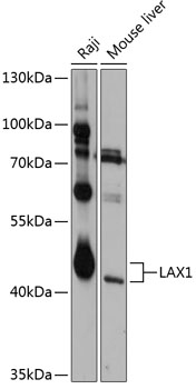 Western blot analysis of extracts of various cell lines using LAX1 Polyclonal Antibody at 1:1000 dilution.