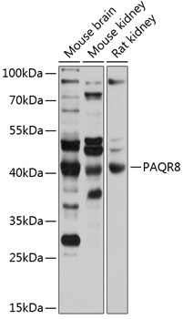 Western blot analysis of extracts of various cell lines using PAQR8 Polyclonal Antibody at 1:1000 dilution.