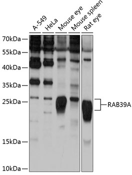 Western blot analysis of extracts of various cell lines using RAB39A Polyclonal Antibody at 1:1000 dilution.