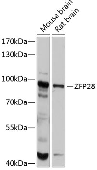 Western blot analysis of extracts of various cell lines using ZFP28 Polyclonal Antibody at 1:1000 dilution.