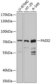 Western blot analysis of extracts of various cell lines using PADI2 Polyclonal Antibody at 1:3000 dilution.