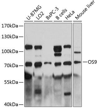 Western blot analysis of extracts of various cell lines using OS9 Polyclonal Antibody at 1:3000 dilution.