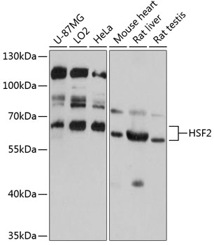 Western blot analysis of extracts of various cell lines using HSF2 Polyclonal Antibody at 1:3000 dilution.