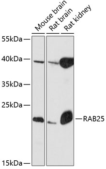 Western blot analysis of extracts of various cell lines using RAB25 Polyclonal Antibody at 1:3000 dilution.