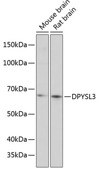 Western blot analysis of extracts of various cell lines using DPYSL3 Polyclonal Antibody at 1:1000 dilution.