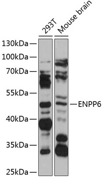 Western blot analysis of extracts of various cell lines using ENPP6 Polyclonal Antibody at 1:1000 dilution.