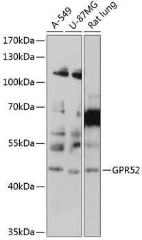 Western blot analysis of extracts of various cell lines using GPR52 Polyclonal Antibody at 1:1000 dilution.