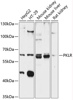 Western blot analysis of extracts of various cell lines using PKLR Polyclonal Antibody at 1:3000 dilution.