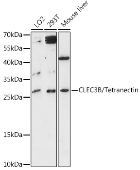 Western blot analysis of extracts of various cell lines using CLEC3B/Tetranectin Polyclonal Antibody at 1:3000 dilution.