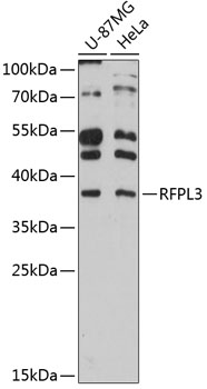 Western blot analysis of extracts of various cell lines using RFPL3 Polyclonal Antibody at 1:3000 dilution.