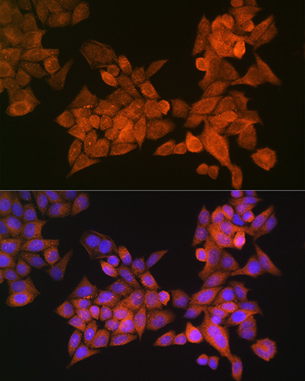 Immunofluorescence analysis of HeLa cells using PALLD Polyclonal Antibody at dilution of 1:100 (40x lens). Blue: DAPI for nuclear staining.