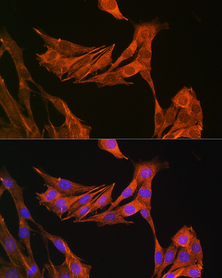 Immunofluorescence analysis of NIH-3T3 cells using PALLD Polyclonal Antibody at dilution of 1:100 (40x lens). Blue: DAPI for nuclear staining.