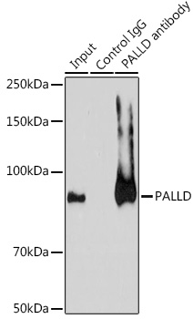 Immunoprecipitation analysis of 200ug extracts of A-549 cells using 3ug PALLD Polyclonal Antibody.Western blot was performed from the immunoprecipitate using PALLD Polyclonal Antibody at a dilution of 1:1000.