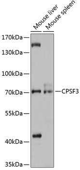 Western blot analysis of extracts of various cell lines using CPSF3 Polyclonal Antibody at 1:3000 dilution.