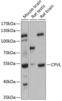 Western blot analysis of extracts of various cell lines using CPVL Polyclonal Antibody at 1:3000 dilution.