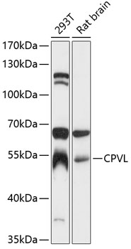 Western blot analysis of extracts of various cell lines using CPVL Polyclonal Antibody at 1:3000 dilution.