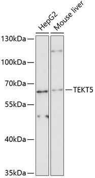 Western blot analysis of extracts of various cell lines using TEKT5 Polyclonal Antibody at 1:3000 dilution.