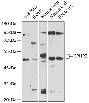 Western blot analysis of extracts of various cell lines using CRHR2 Polyclonal Antibody at 1:1000 dilution.