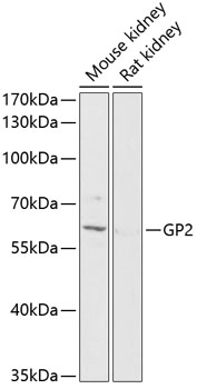 Western blot analysis of extracts of various cell lines using GP2 Polyclonal Antibody at 1:1000 dilution.