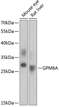 Western blot analysis of extracts of various cell lines using GPM6A Polyclonal Antibody at 1:1000 dilution.