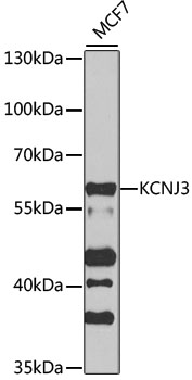 Western blot analysis of extracts of MCF7 cells using KCNJ3 Polyclonal Antibody at 1:1000 dilution.