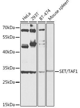 Western blot analysis of extracts of various cell lines using SET/TAF1 Polyclonal Antibody at 1:1000 dilution.