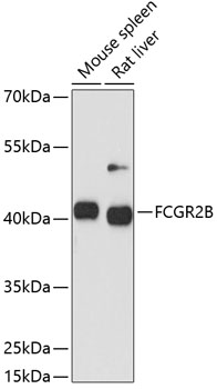Western blot analysis of extracts of various cell lines using FCGR2B Polyclonal Antibody at 1:1000 dilution.