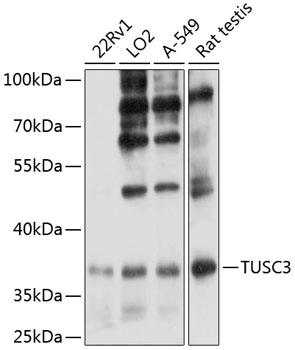 Western blot analysis of extracts of various cell lines using TUSC3 Polyclonal Antibody at 1:3000 dilution.