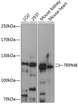 Western blot analysis of extracts of various cell lines using TRPM8 Polyclonal Antibody at 1:3000 dilution.