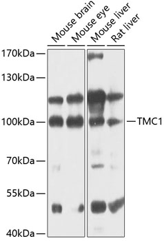 Western blot analysis of extracts of various cell lines using TMC1 Polyclonal Antibody at 1:1000 dilution.