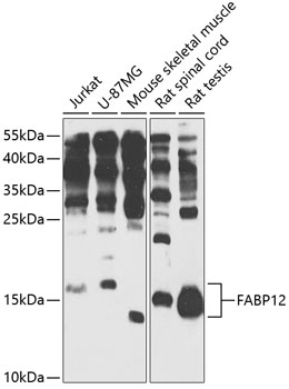 Western blot analysis of extracts of various cell lines using FABP12 Polyclonal Antibody at 1:1000 dilution.