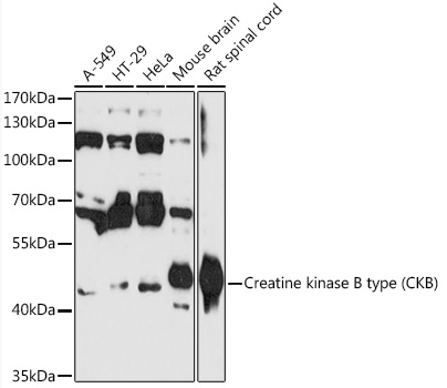 Western blot analysis of extracts of various cell lines using Creatine kinase B type Polyclonal Antibody at1:3000 dilution.