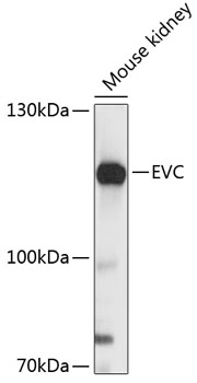 Western blot analysis of extracts of mouse kidney using EVC Polyclonal Antibody at 1:3000 dilution.